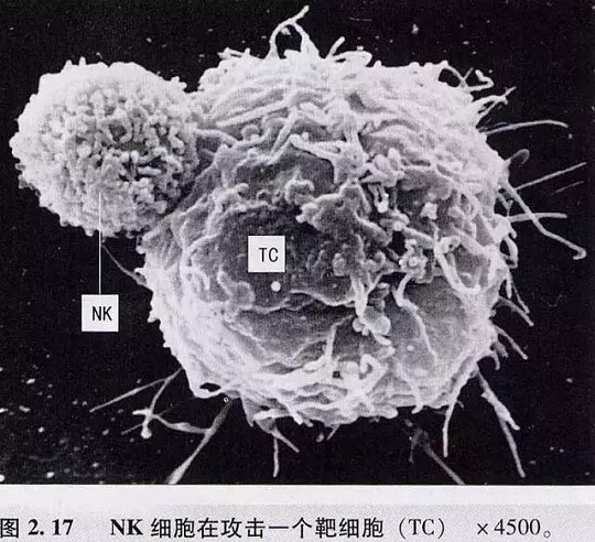 NK干細胞存儲有什么用