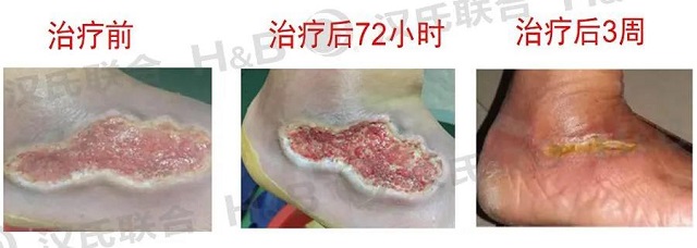 漢氏聯合